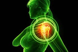 Hormonen en frozen shoulder